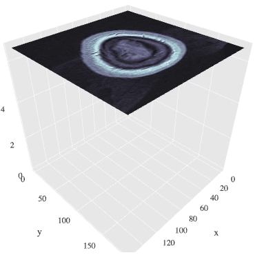 Visualizing MRI Volume Slices